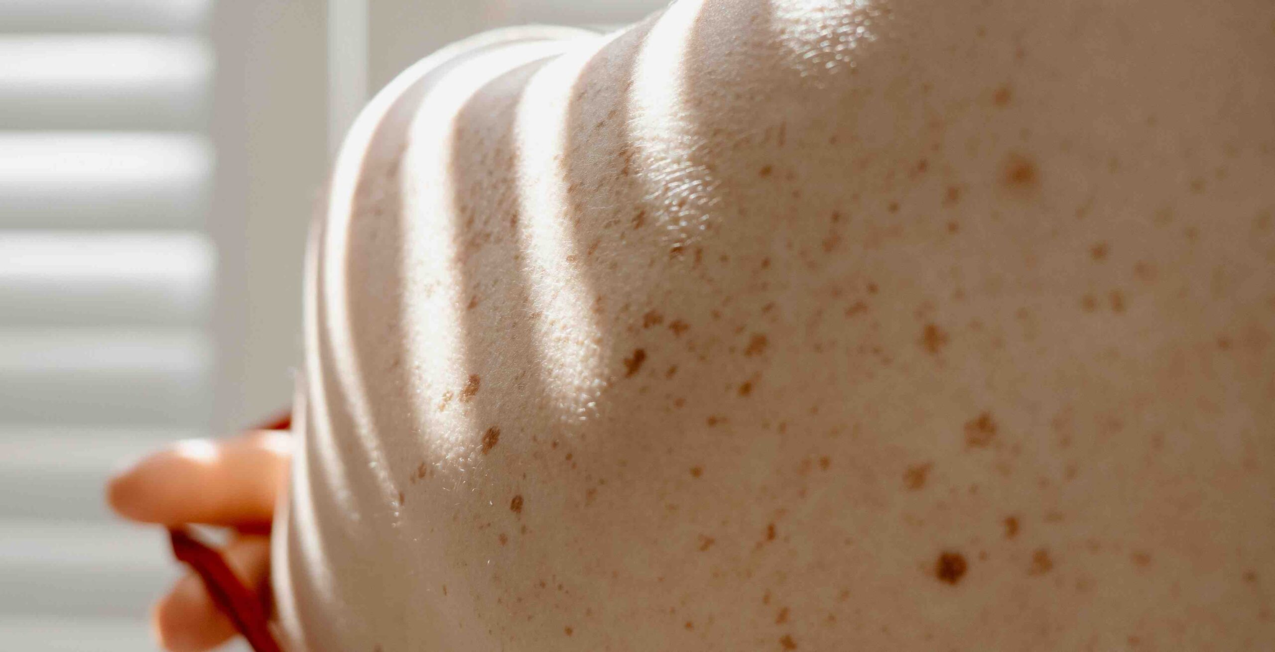 Licht und Schatten auf gesunder Haut Licht und Schatten auf Haut